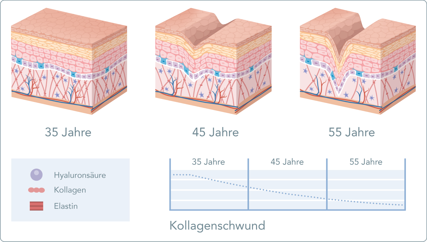 Hautalterung - Die Hautalterung Intensität