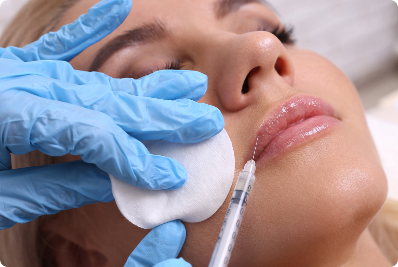 Lippen aufspritzen (Lippenvergrößerung) - Wie lassen sich die Lippen mit Hyaluron aufspritzen?