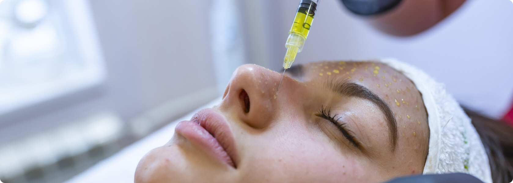 Mesotherapie - Wie läuft eine Mesotherapie ab?