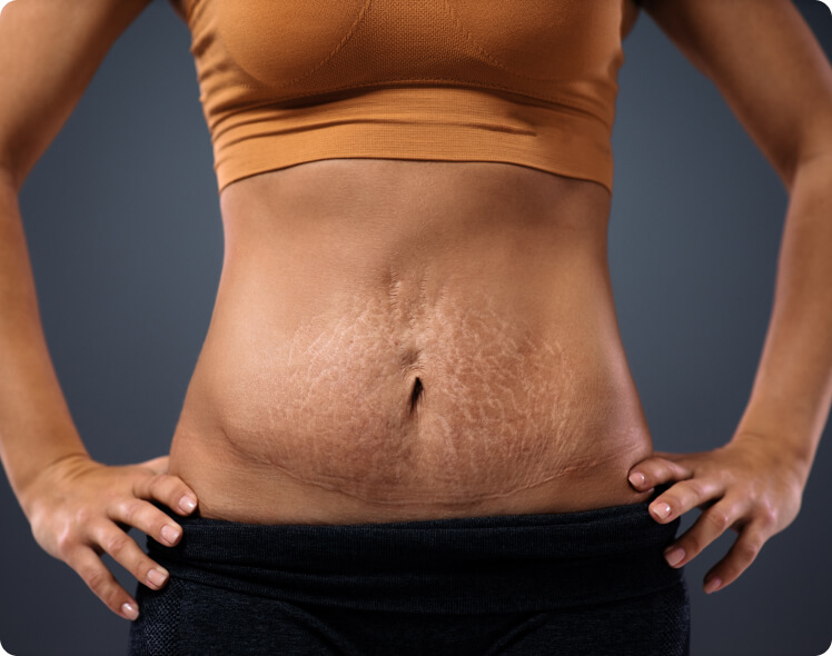Mesotherapie - Wie lassen sich Wunden und Narben mit der Mesotherapie behandeln?