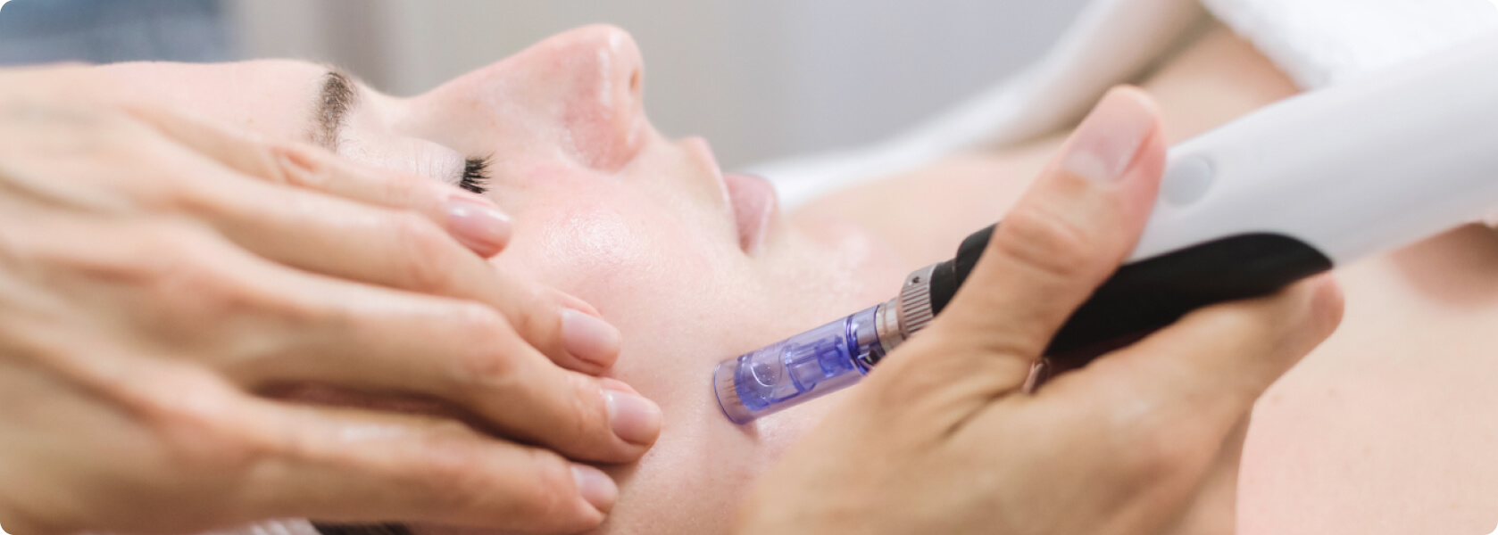 Microneedling - Was ist der Unterschied zwischen einem Microneedling und einem Medical Needling?