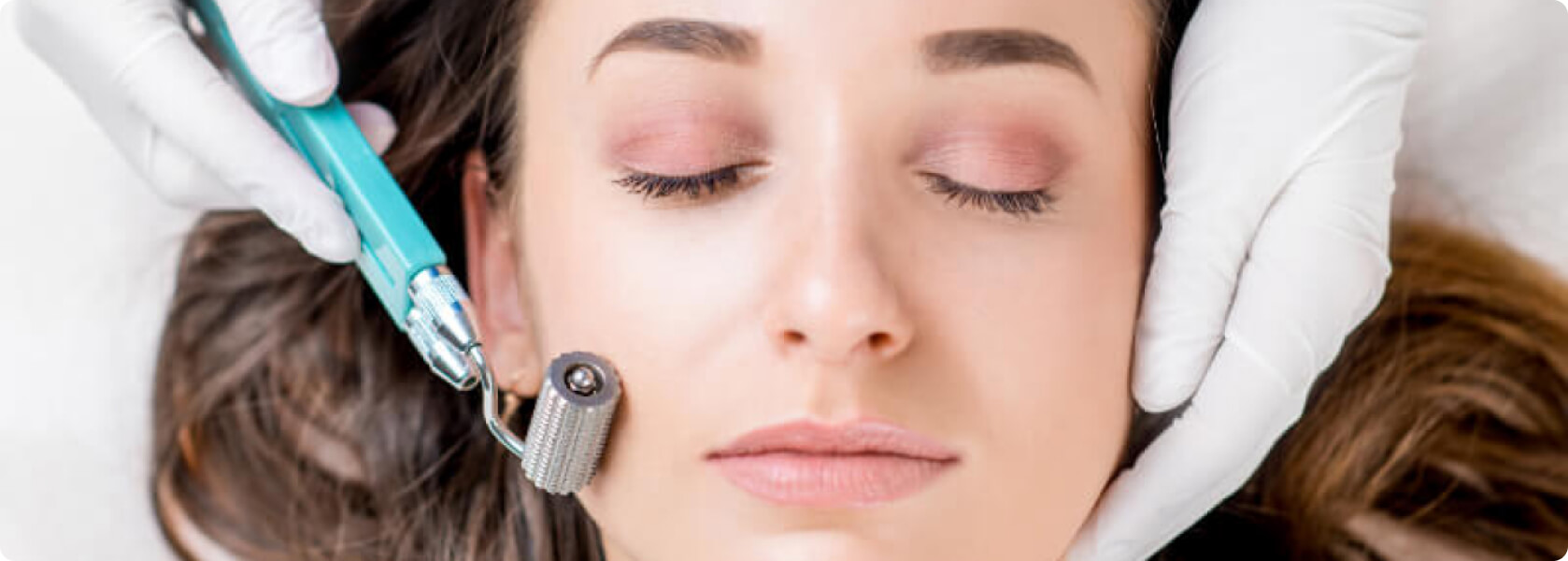 Microneedling - Was genau ist Microneedling?