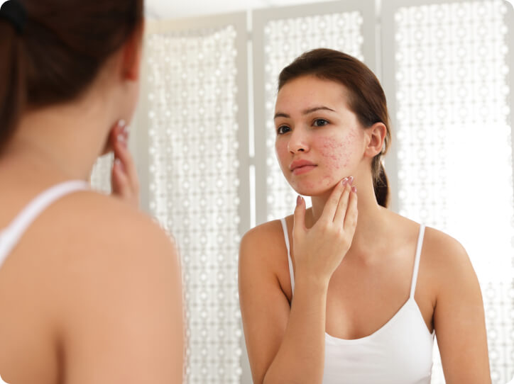 Mikrodermabrasion (Microdermabrasion) - Für welche Anwendungsgebiete kommt die Mikrodermabrasion infrage?