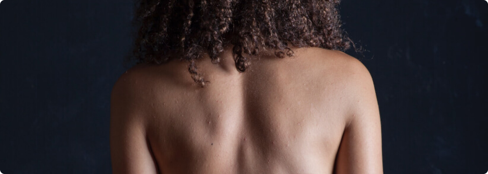Dermatitis - Welche Risikofaktoren begünstigen eine Dermatitis?