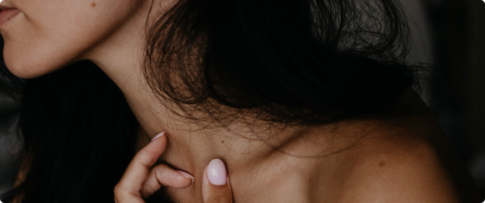 Tinea (Dermatophytose) - Was ist eine Tinea?