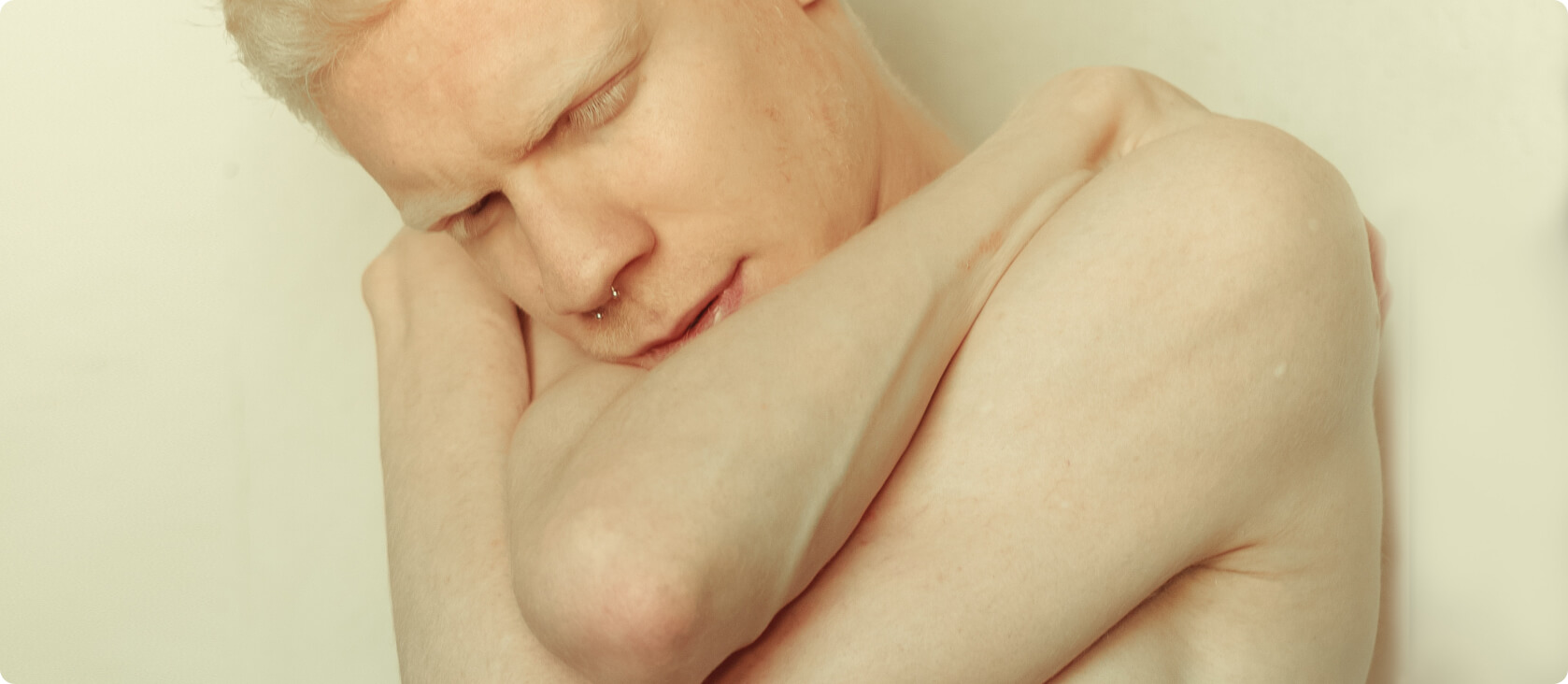 Gürtelrose (Herpes Zoster) - Wie lange bin ich mit Herpes Zoster krankschreiben?