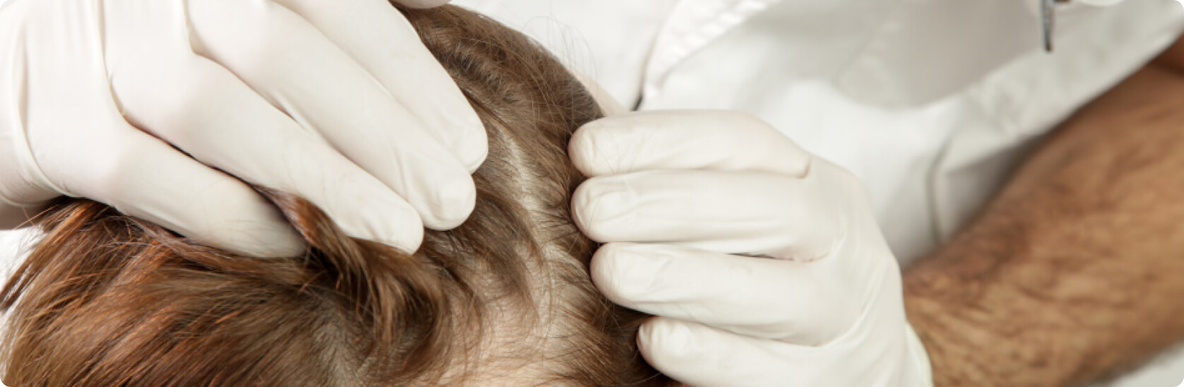 Juckende Kopfhaut - Wie diagnostiziert der Arzt eine juckende Kopfhaut?
