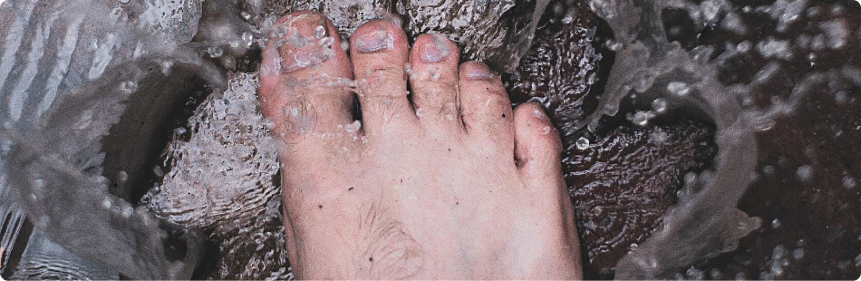 Nagelpilz - Ist eine Nagelmykose ansteckend?