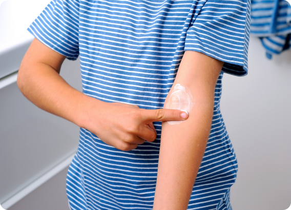 Neurodermitis (Atopische Dermatitis) - Was sind die Ursachen von Neurodermitis?