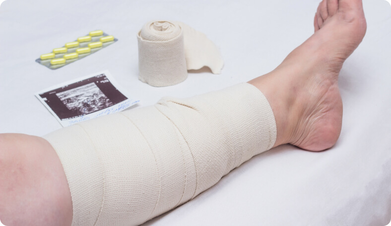 Pannikulitis - Wie lässt sich eine Pannikulitis behandeln?