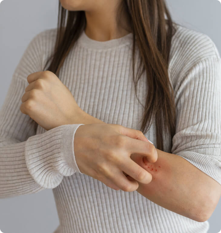 Schuppenflechte (Psoriasis) - Von welchen Krankheiten muss eine Psoriasis abgegrenzt werden?