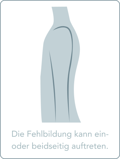 Amastie - Was ist die Scharlach-Angina?