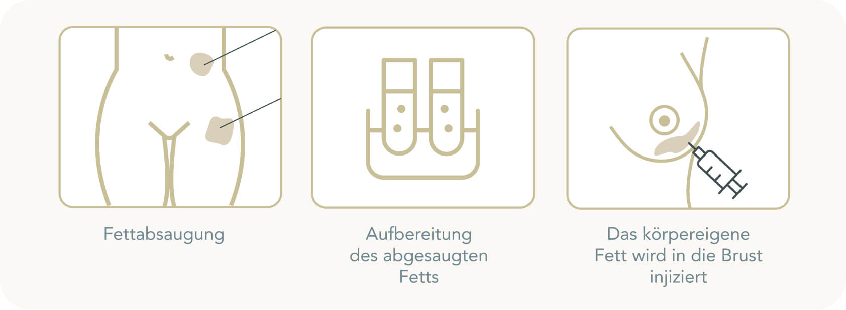 Brustvergrößerung mit Eigenfett