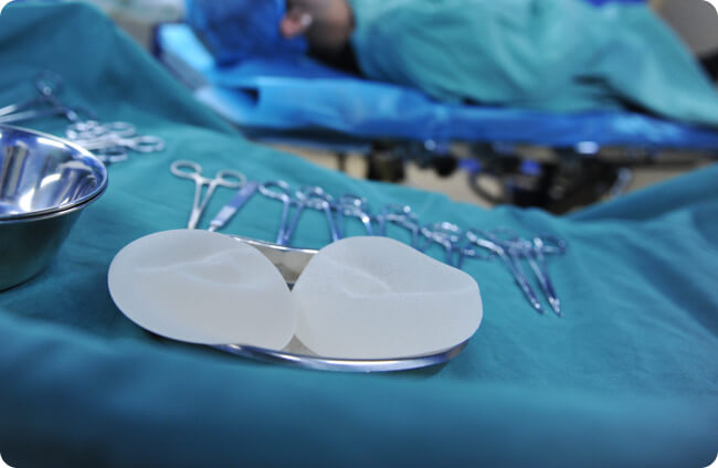 kapselfibrose - Wann ist bei einer Kapselfibrose ein Implantatwechsel notwendig?
