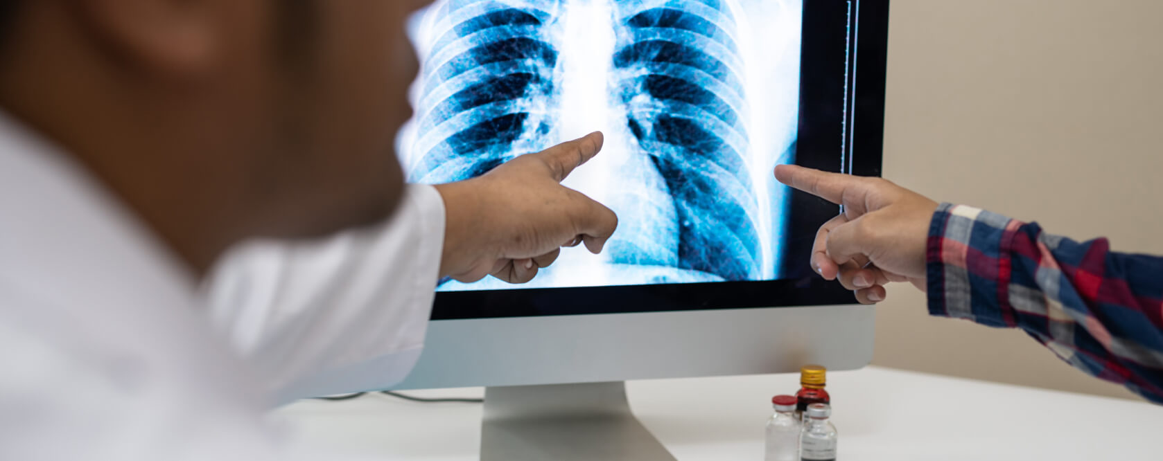 Kielbrust - Wie diagnostiziert der Arzt eine Kielbrust?