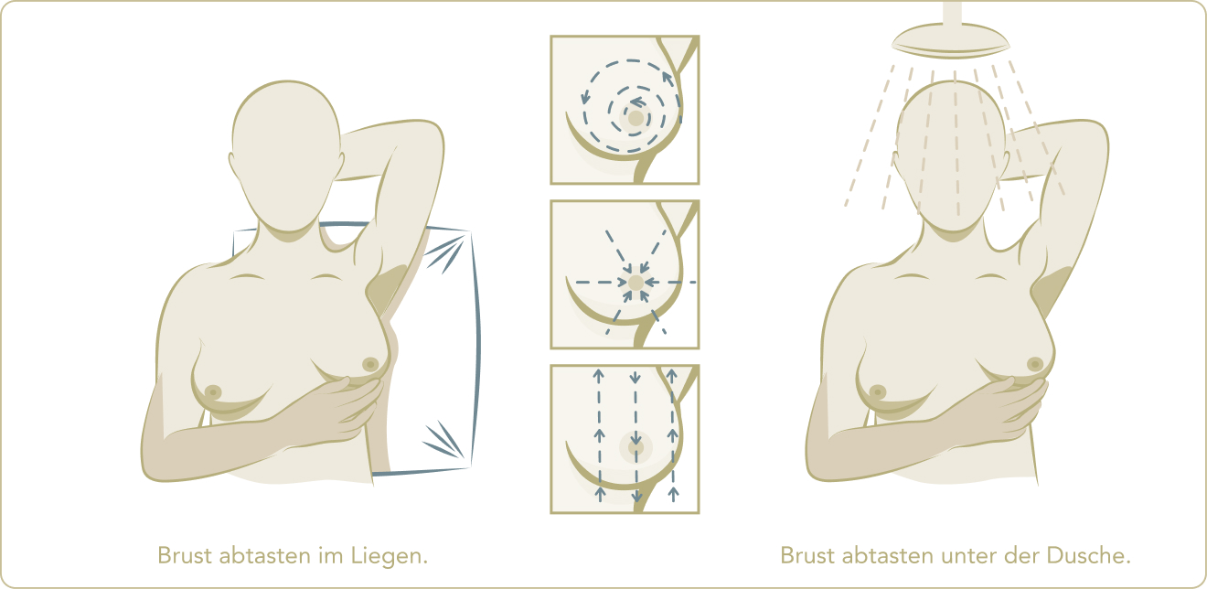 Mammographie - Wie kann ich meine Brüste auf Veränderungen abtasten?