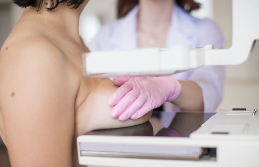 Mammographie - Wie läuft eine Mammographie ab?