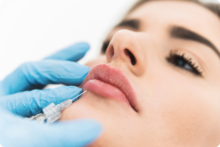 Hyaluronsäure - Lippenvergrößerung und Änderung der Lippenform