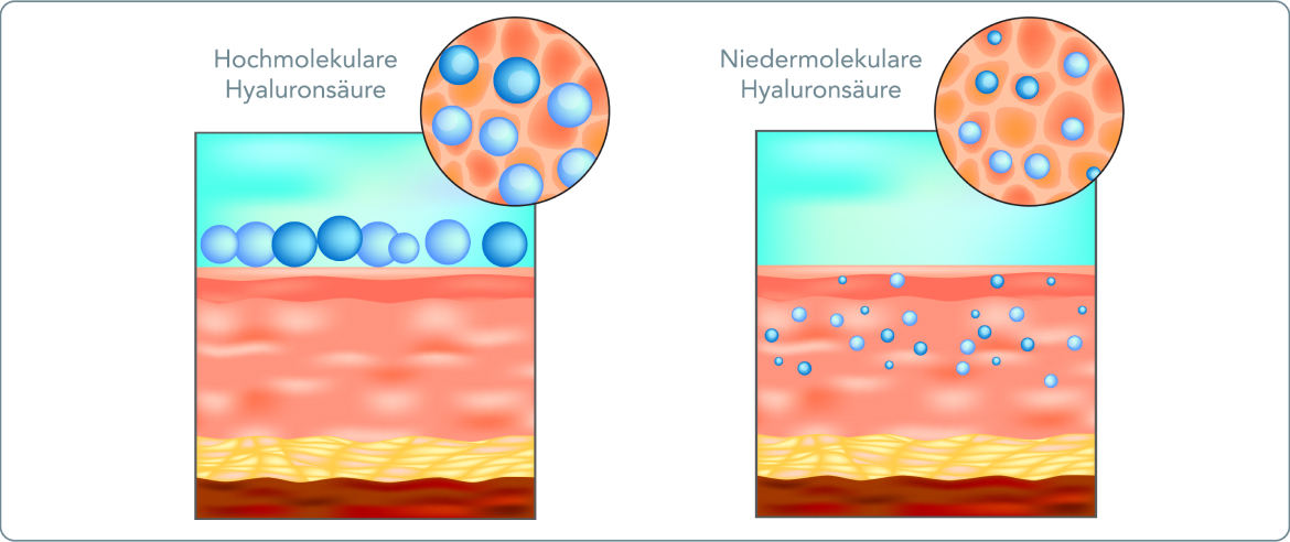 Hyaluronsäure - Welche unterschiedlichen Arten von Hyaluronsäure gibt es?