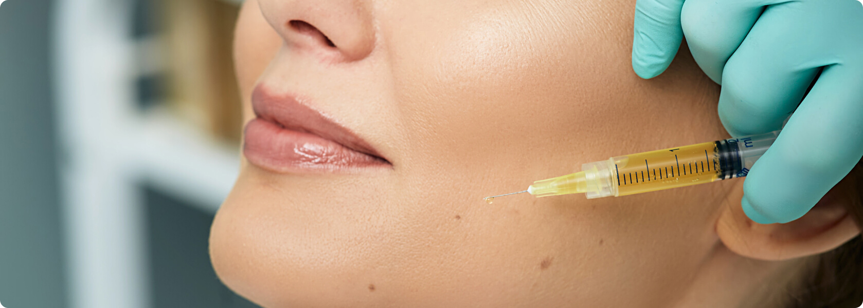 Lipofilling – Eigenfettunterspritzung - Was ist ein Lipofilling?