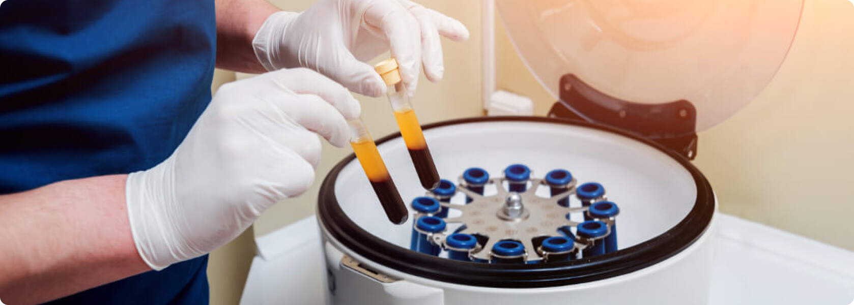 PRP-Behandlung (Vampir Lifting) - Was muss ich vor der Plasma-Therapie beachten?