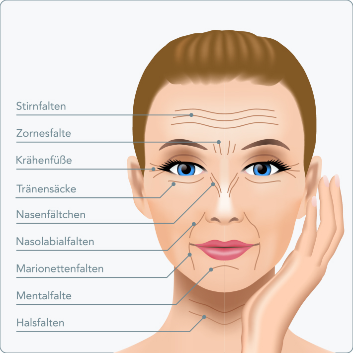 Facelift - Welche Arten des Facelifts gibt es?