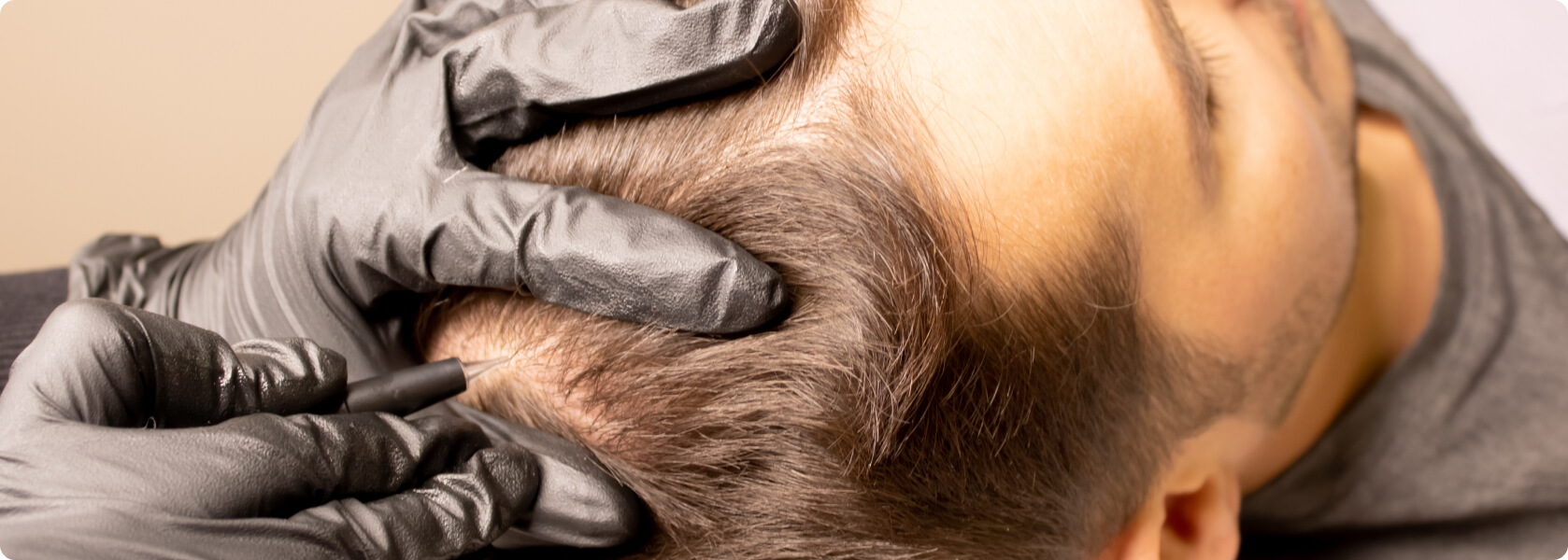 Haarpigmentierung - Was ist eine Haarpigmentierung?