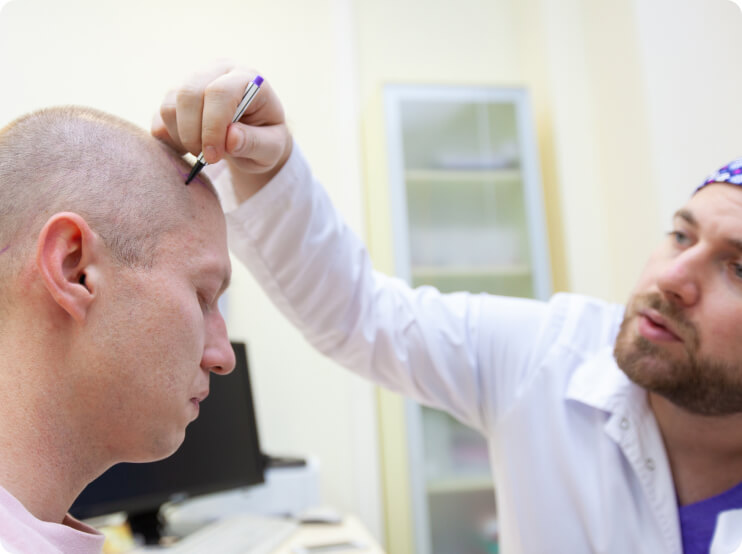 Haartransplantation - Welche Vorbereitungen sind bei einer Haartransplantation notwendig?
