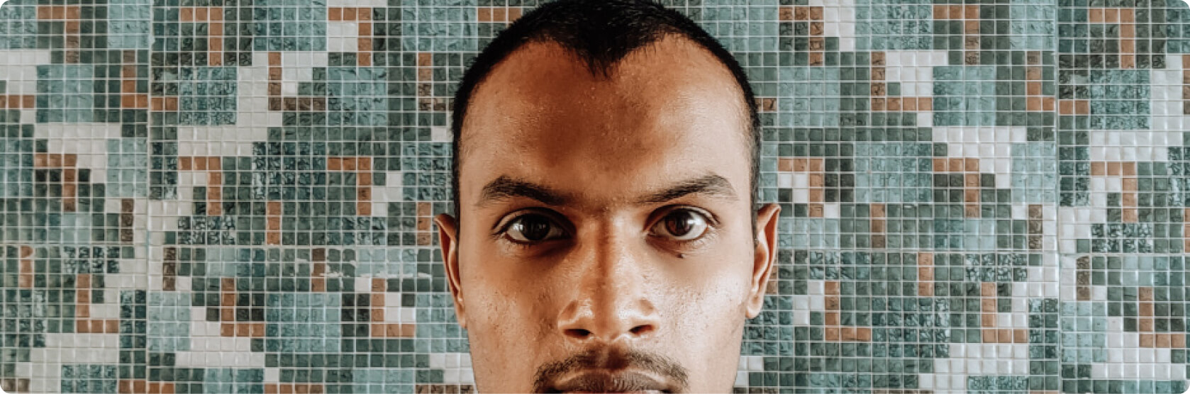 Haartransplantation - Was ist eine Haartransplantation?