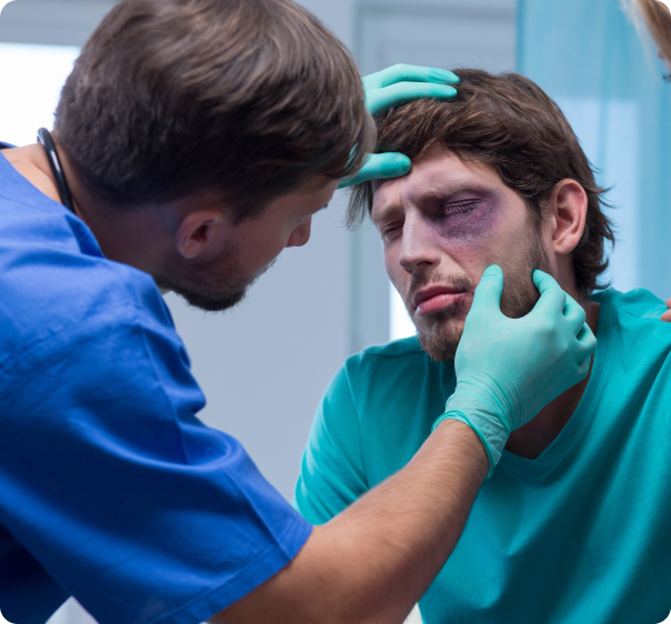 Jochbeinbruch - Welche Ursachen hat ein Jochbeinbruch?