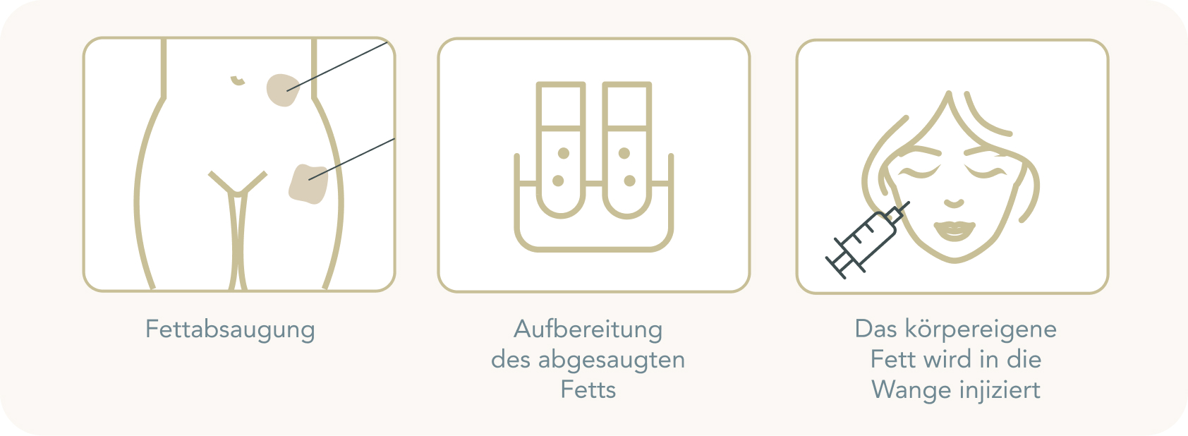 Wangenkorrektur - Wie lassen sich die Wangen mithilfe einer Eigenfett-Injektion korrigieren?