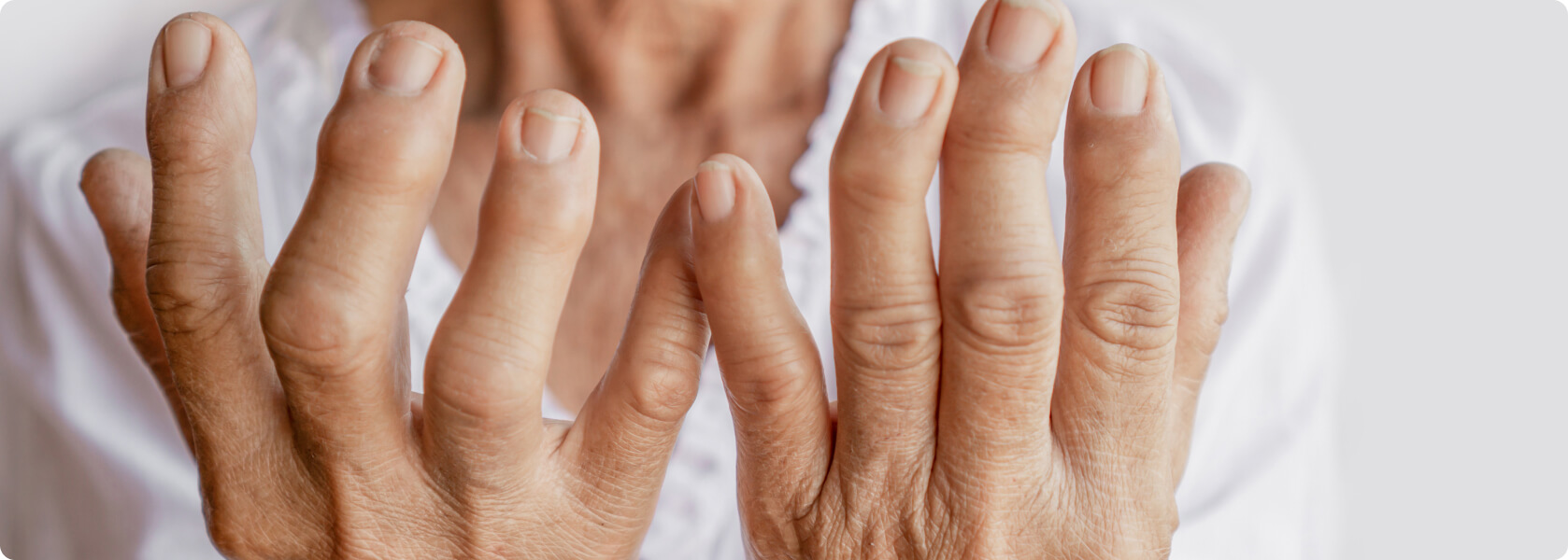 Arthrose - Was ist der Unterschied zwischen Arthrose und Arthritis?