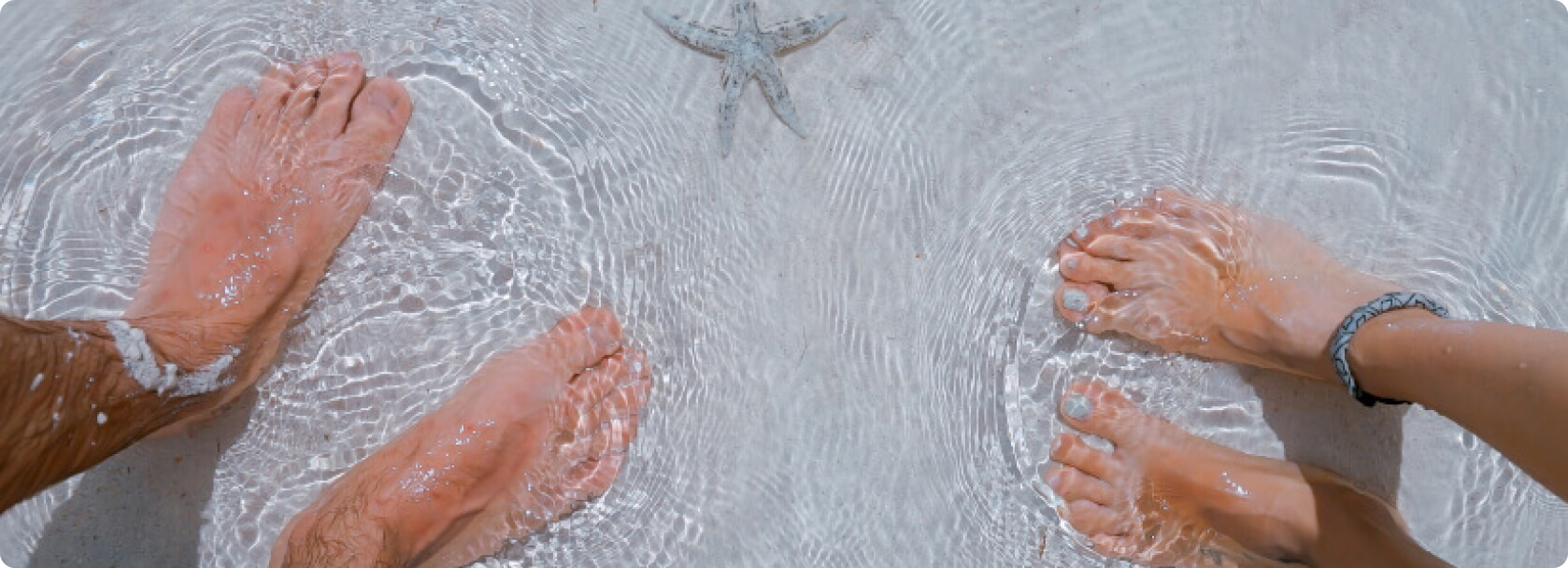 Hallux valgus - Wie kann ich einem Hallux valgus vorbeugen?
