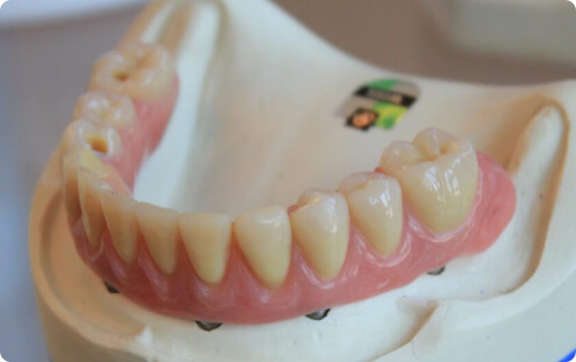 Craniomandibuläre Dysfunktion (CMD) - Wie diagnostiziert der Arzt eine Craniomandibulären Dysfunktion?