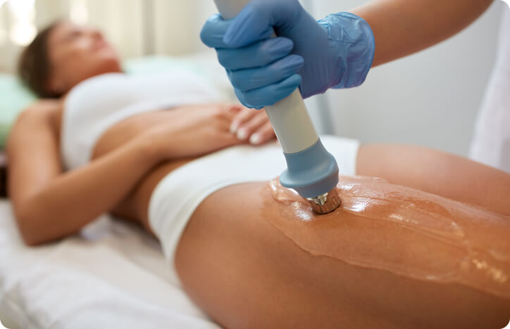 Cellulite - Lasertherapie