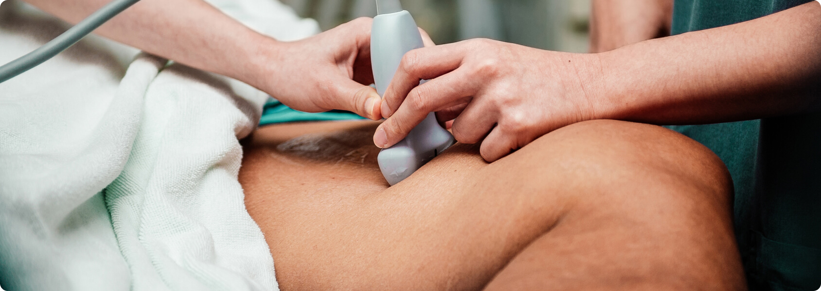 Lipödem - Wie diagnostiziert der Arzt ein Lipödem?