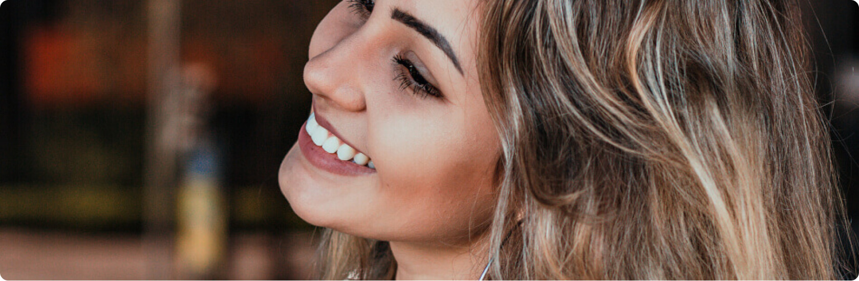 Veneers - Was muss ich vor und nach der Behandlung mit Veneers beachten?