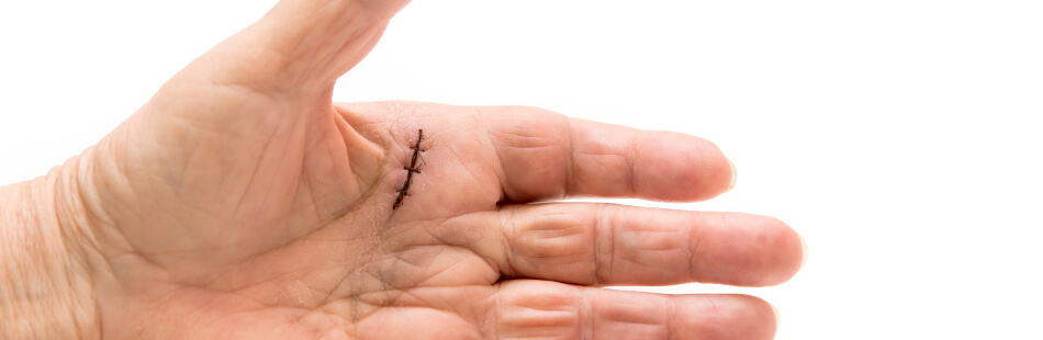 Schnellender Finger