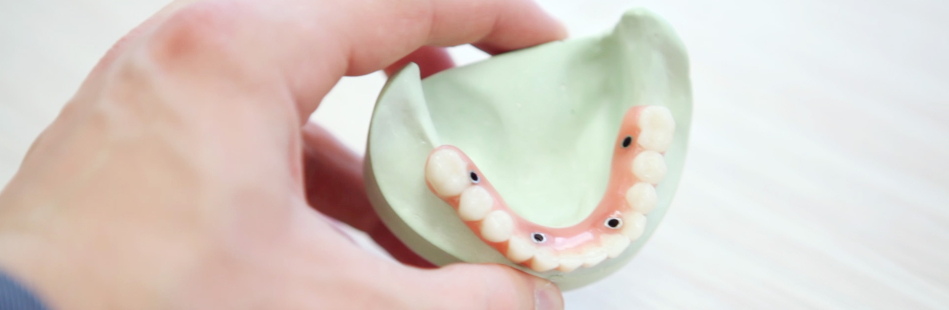 Periimplantitis