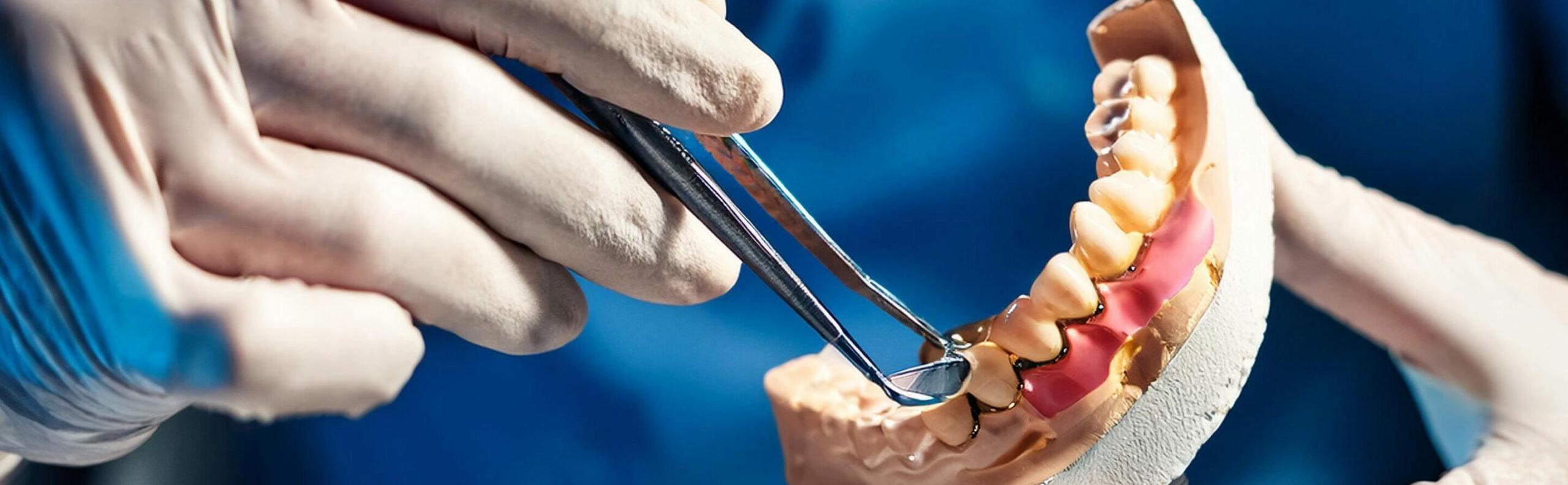 Periimplantitis