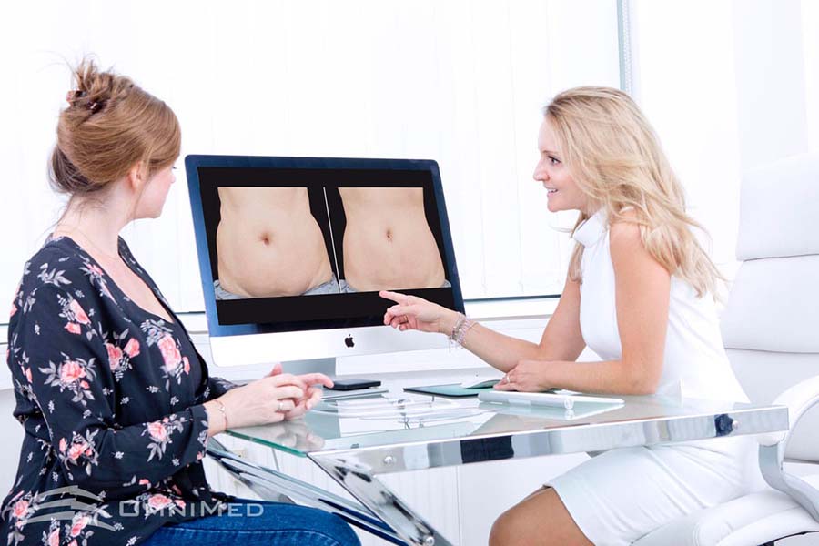 Coolsculpting - Wie funktioniert Coolsculpting