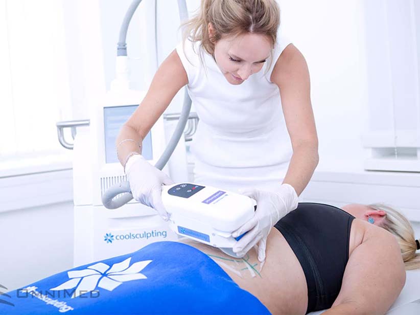 CoolSculpting®