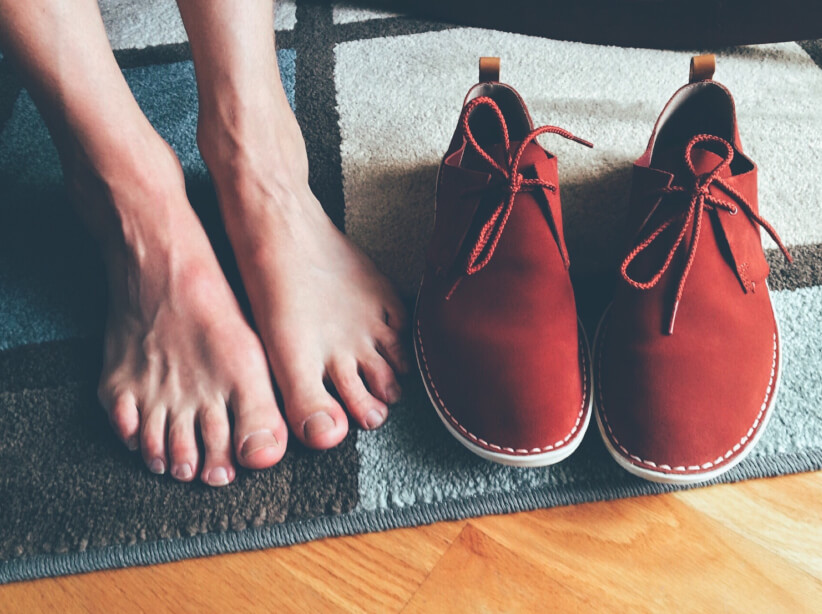 Hallux rigidus (Arthrose des Großzehengrundgelenks)
