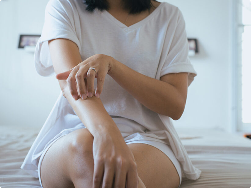 Keratosis Pilaris (Reibeisenhaut)