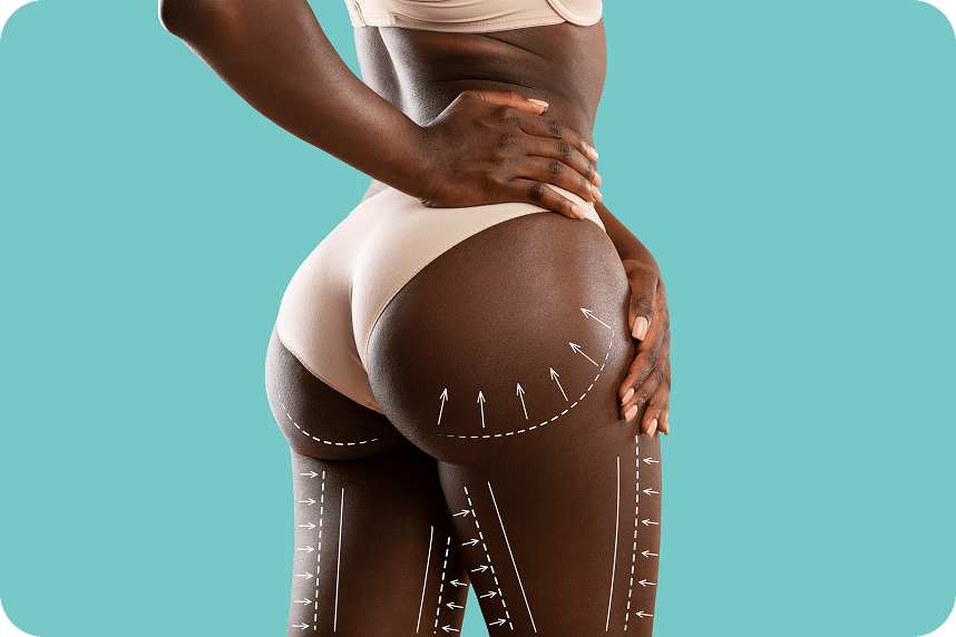 T-Shape 2 Laser
