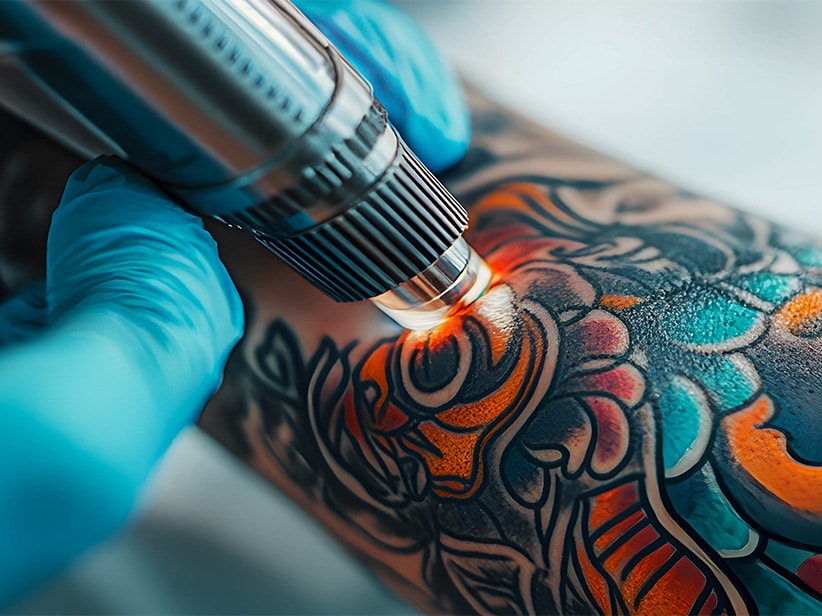 Pikosekundenlaser