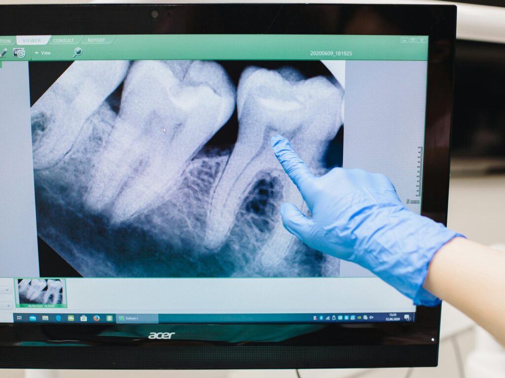Was ist das 3D Röntgen DVT?