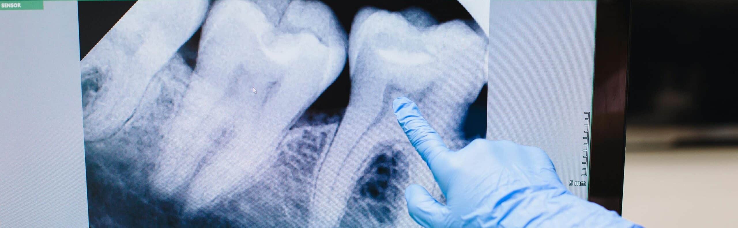 Was ist das 3D Röntgen DVT?